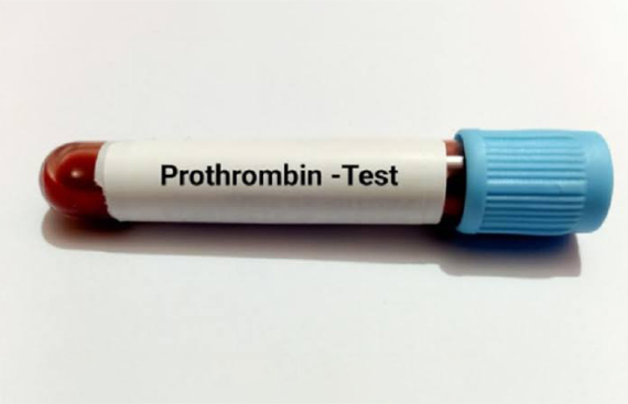What is Prothrombin Time?